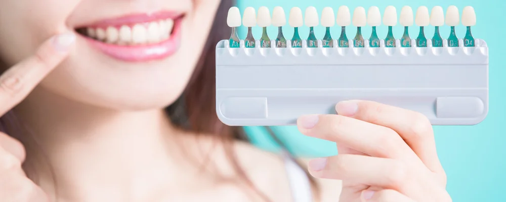 シェードガイドと歯の色を見比べて黄ばみの程度を確かめる女性｜マルイ錦糸町シティデンタルクリニック